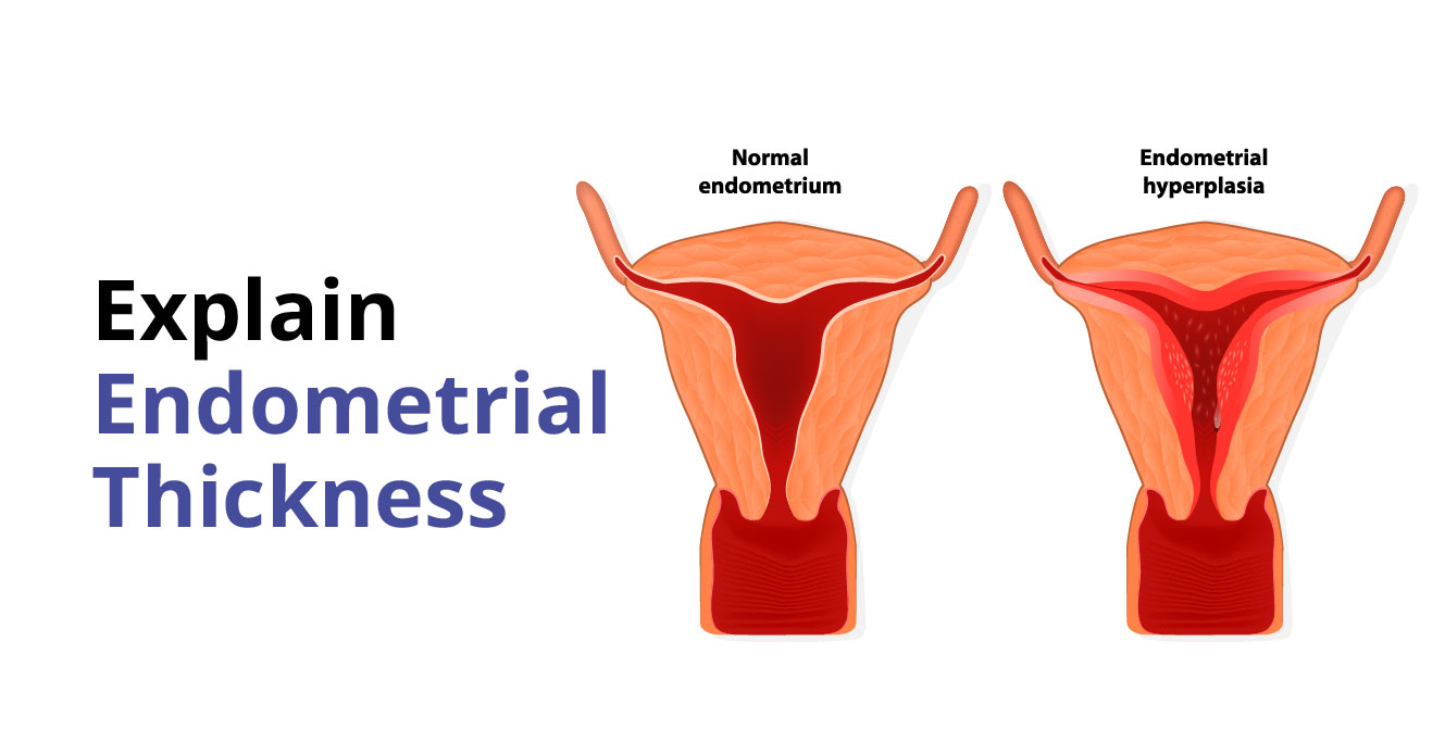 What is Endometrial Thickness