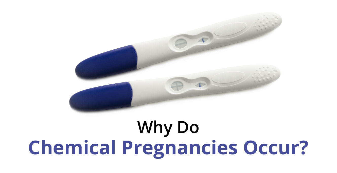 Understanding Chemical Pregnancies and Early Miscarriage