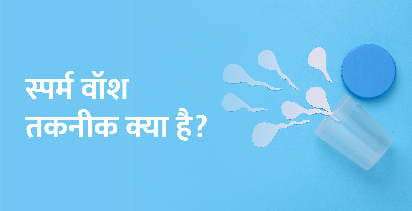 स्पर्म वाश तकनीक क्या है(Sperm Wash Technique in Hindi)
