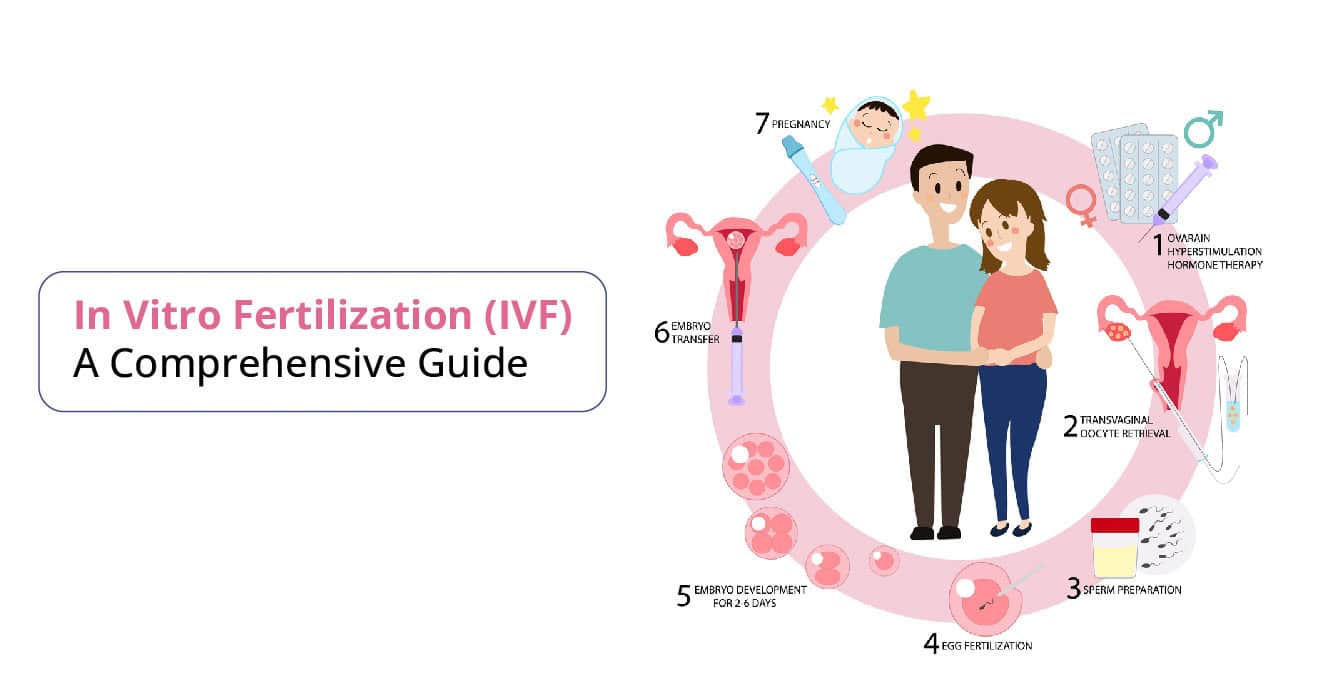 IVF ಚಿಕಿತ್ಸೆ: ನೀವು ತಿಳಿದುಕೊಳ್ಳಬೇಕಾದ ಎಲ್ಲವೂ