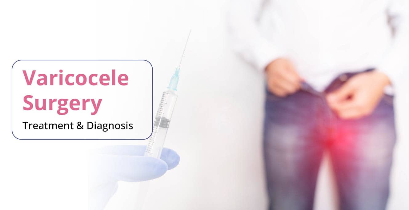 Varicocele: سبب، علامات، تشخيص ۽ علاج