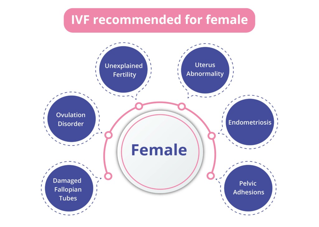 Why is IVF recommended for Female