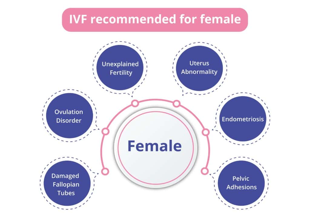 Why is IVF recommended for Female