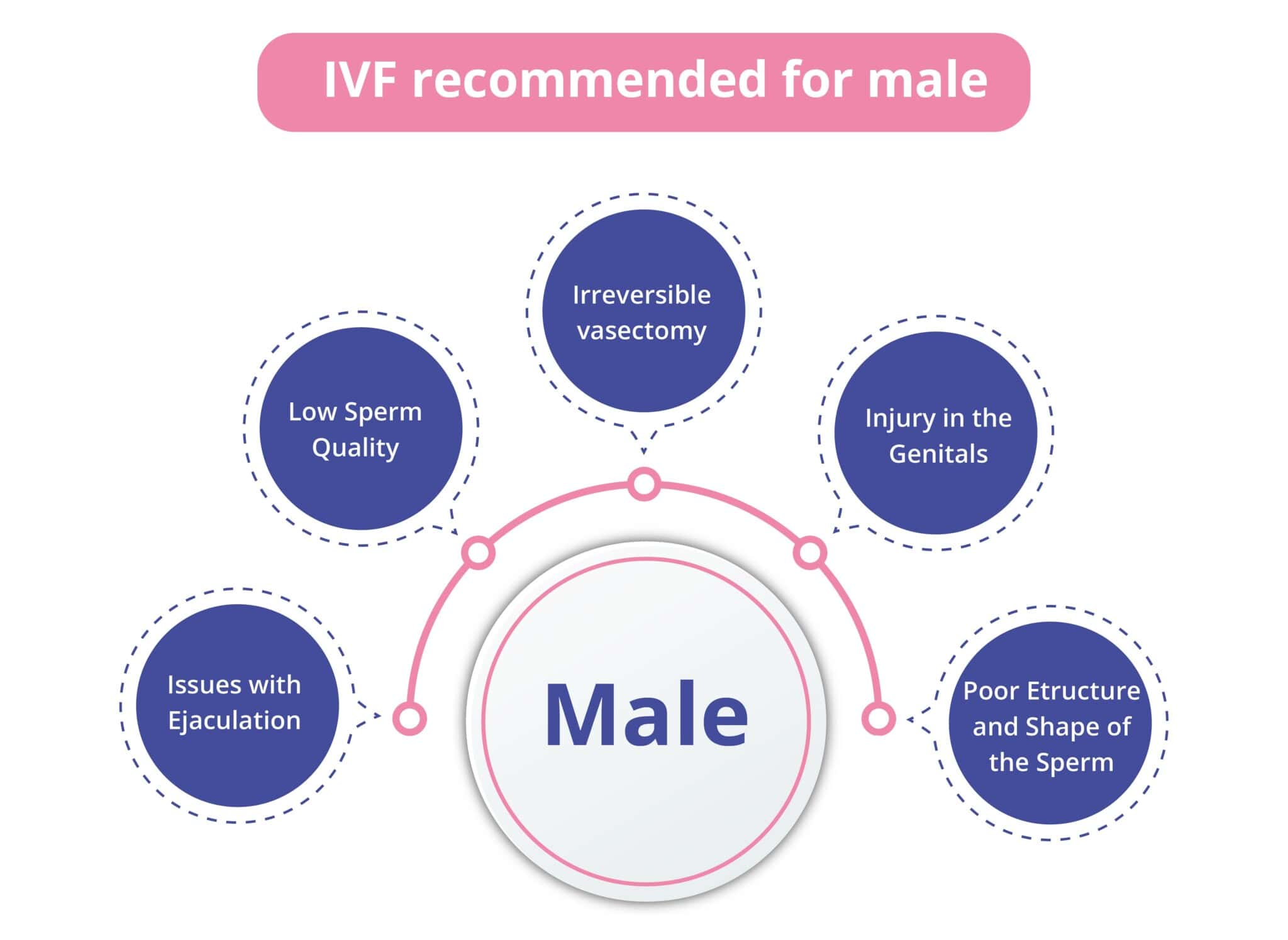 IVF Treatment: Everything You Need To Know | Birla Fertility & IVF