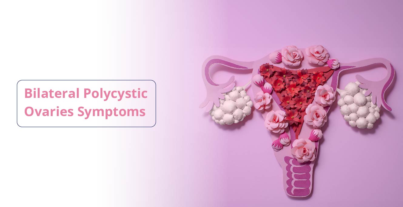 Bilateral Polycystic Ovaries: Symptoms and Treatment