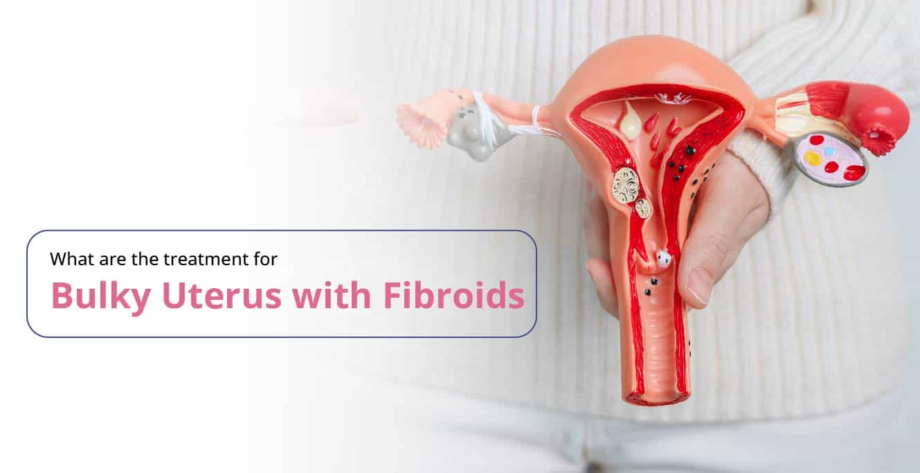 Bulky Uterus with Fibroids: Causes, Symptoms, Treatments & Complications