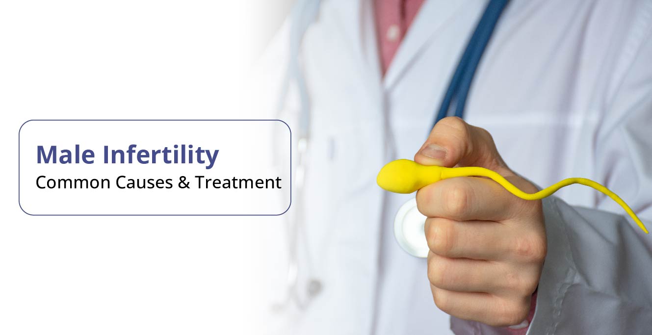 Understanding Male Infertility: Causes, Symptoms, Treatment, and Recovery
