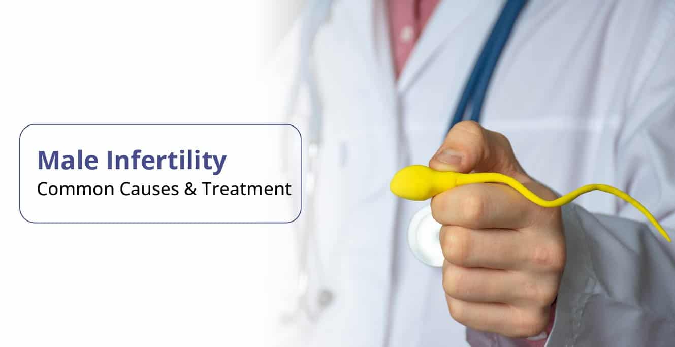 Understanding Male Infertility: Causes, Symptoms, Treatment, and Recovery