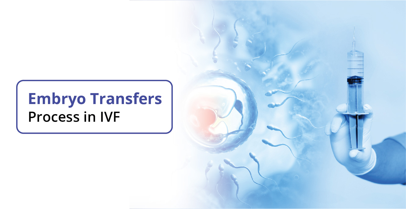 Embryo Transfers Process in IVF: What You Need to Know