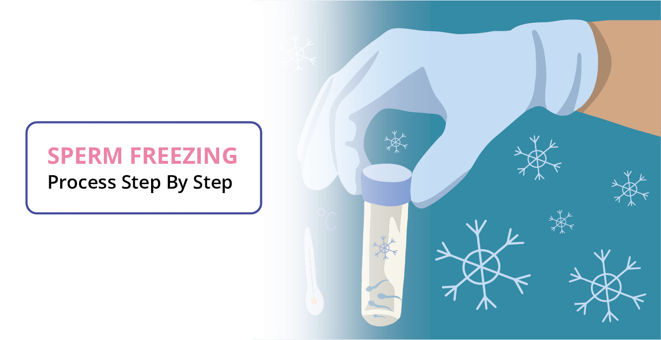 Sperm Freezing: Step by Step Process