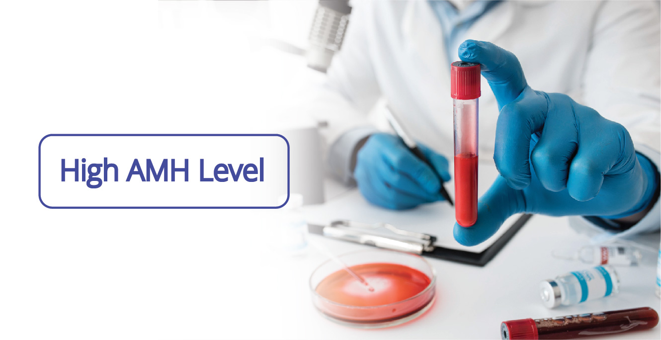 Understand High AMH Levels and Its Fertility Treatment