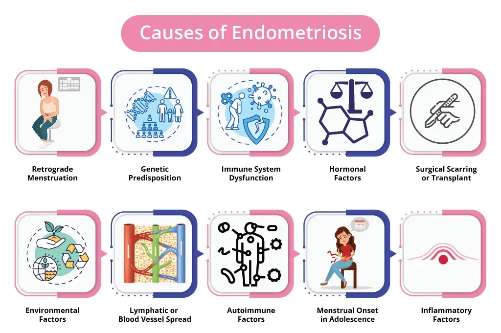 Endometriosis جا سبب