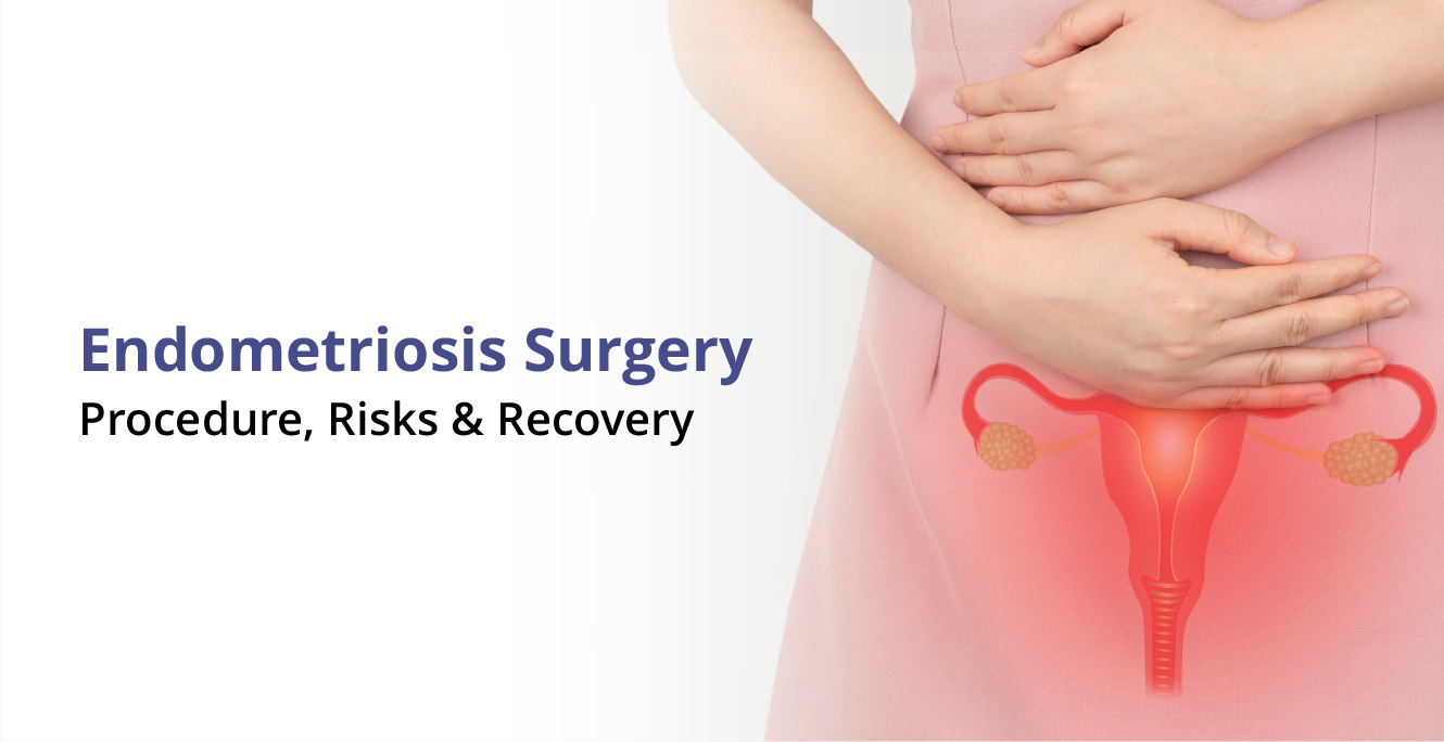 How Endometriosis Surgery Can Bring Relief and Restore Fertility
