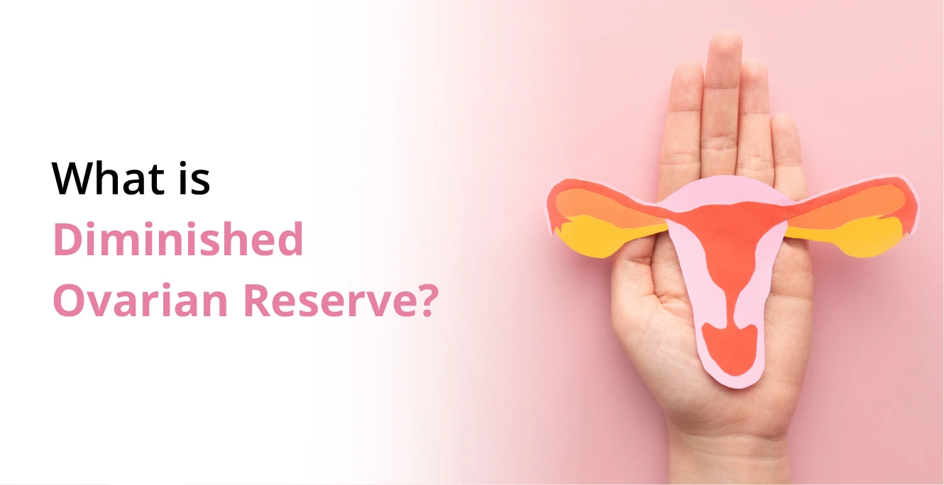 What is Diminished Ovarian Reserve(DOR)? Causes, Symptoms and Treatment