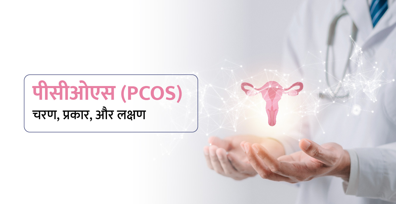 पीसीओएस (PCOS): चरण, प्रकार, और लक्षण