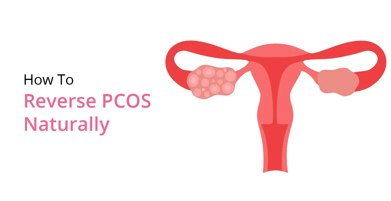 How To Reverse PCOS Naturally